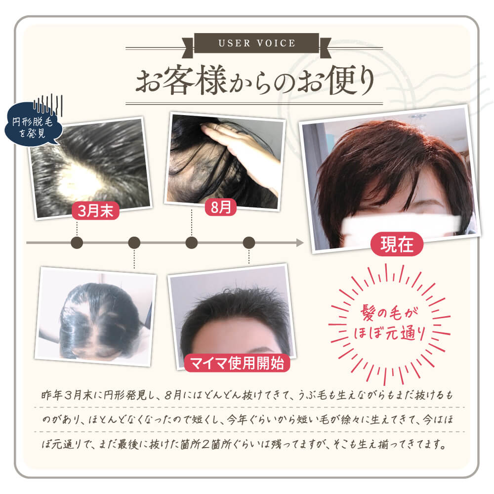 育毛ヘアローション