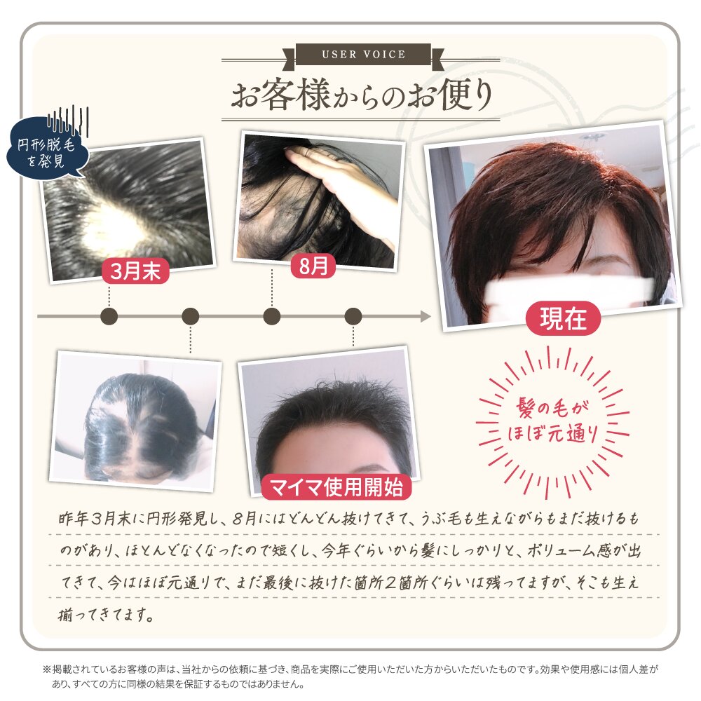 育毛ヘアローション